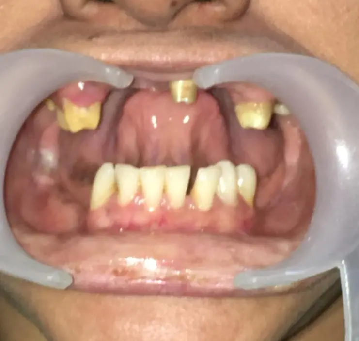 Before dental case 2